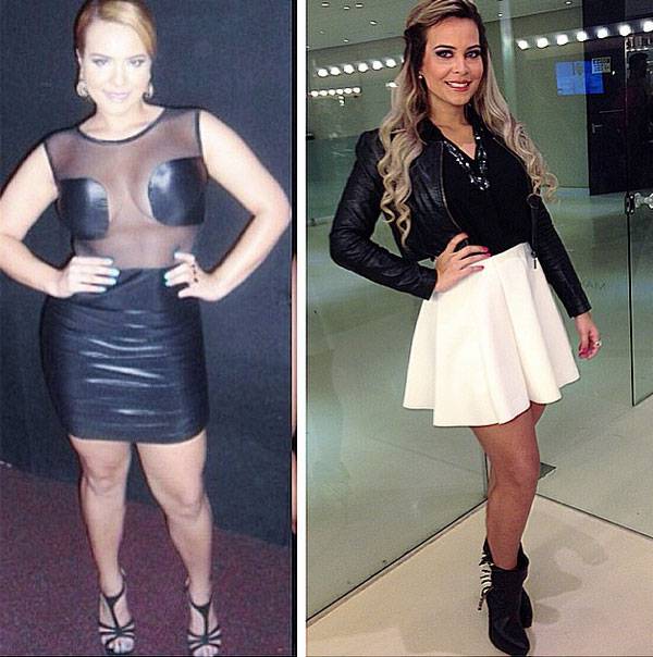 Estética facial de Geisy Arruda: Facetas