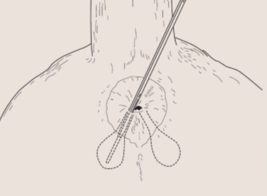 Causas e Como Prevenir