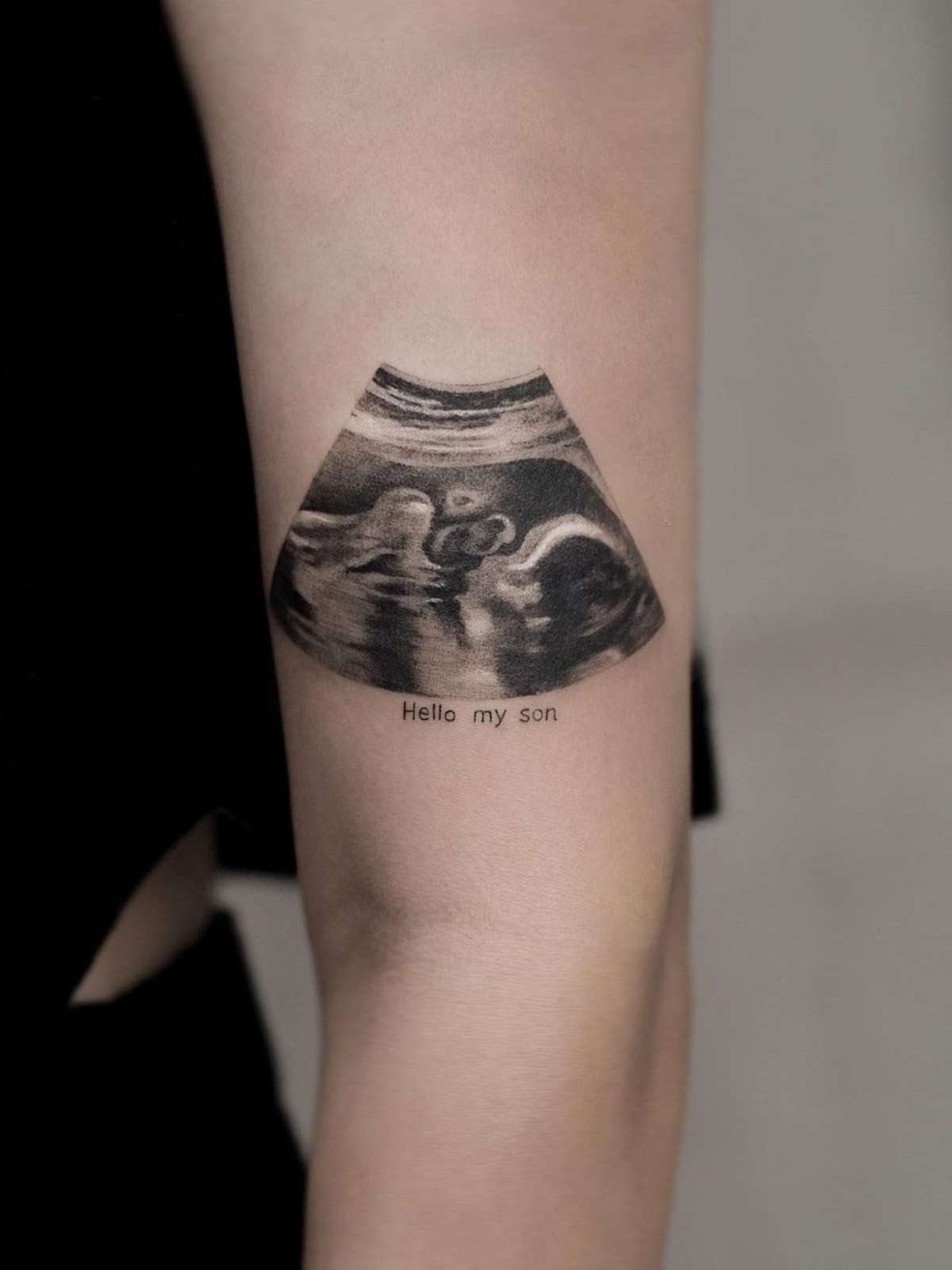 o que fazer se fiz tatuagem grávida sem saber