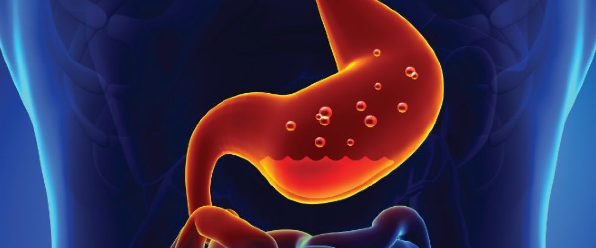 Gastrite vs. Refluxo: Entenda as Diferenças e Sintomas