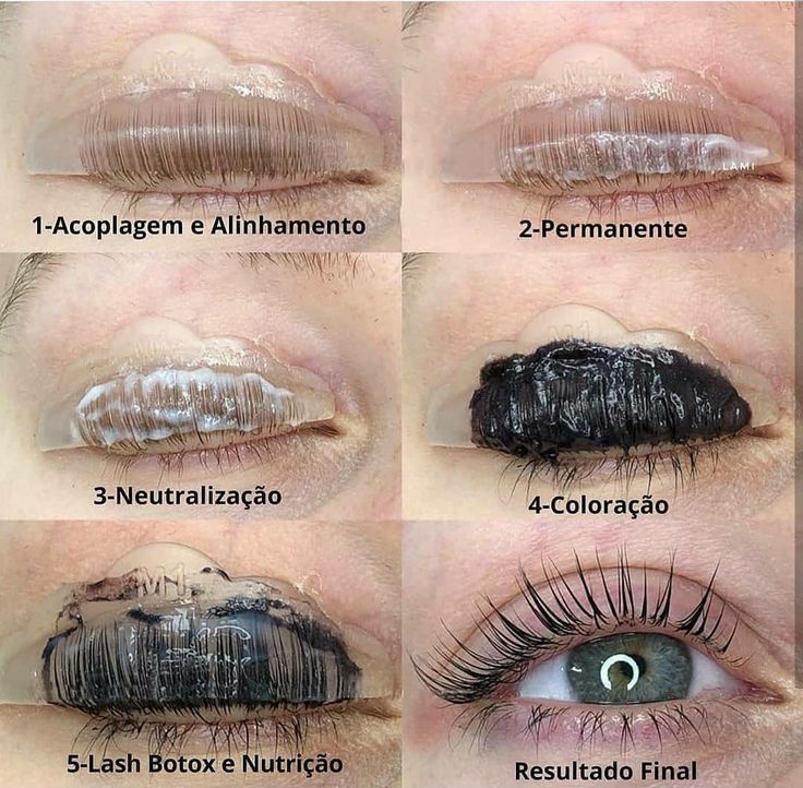lash lifting riscos