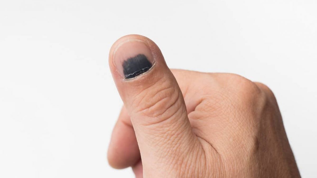 mancha escura na unha trauma ou melanoma como diferenciar