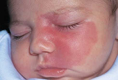 Manchas Vinho do Porto