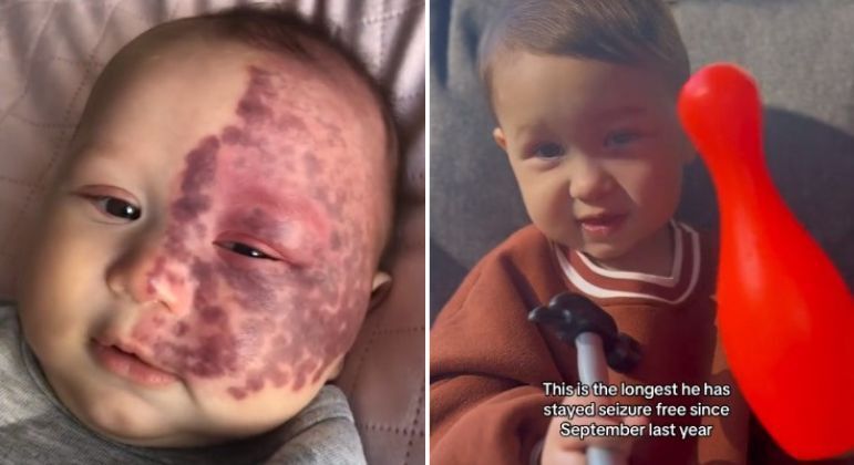 Sintomas e Opções de Tratamento