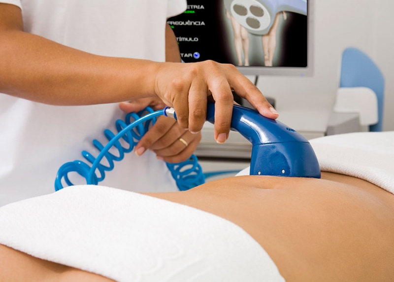 Manthus Antes E Depois