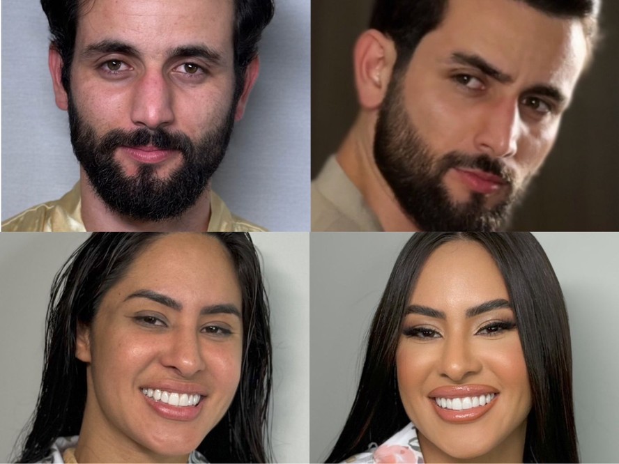 Manthus Antes E Depois