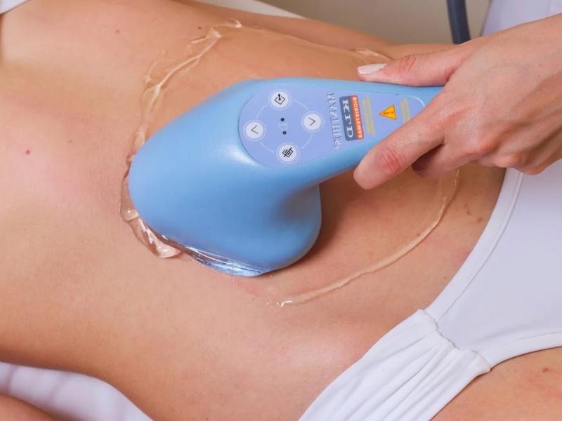 Manthus Antes E Depois