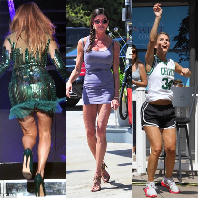 Manthus Antes E Depois