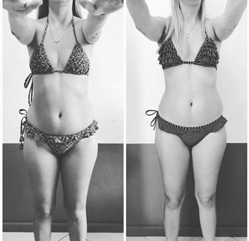 Manthus Antes E Depois