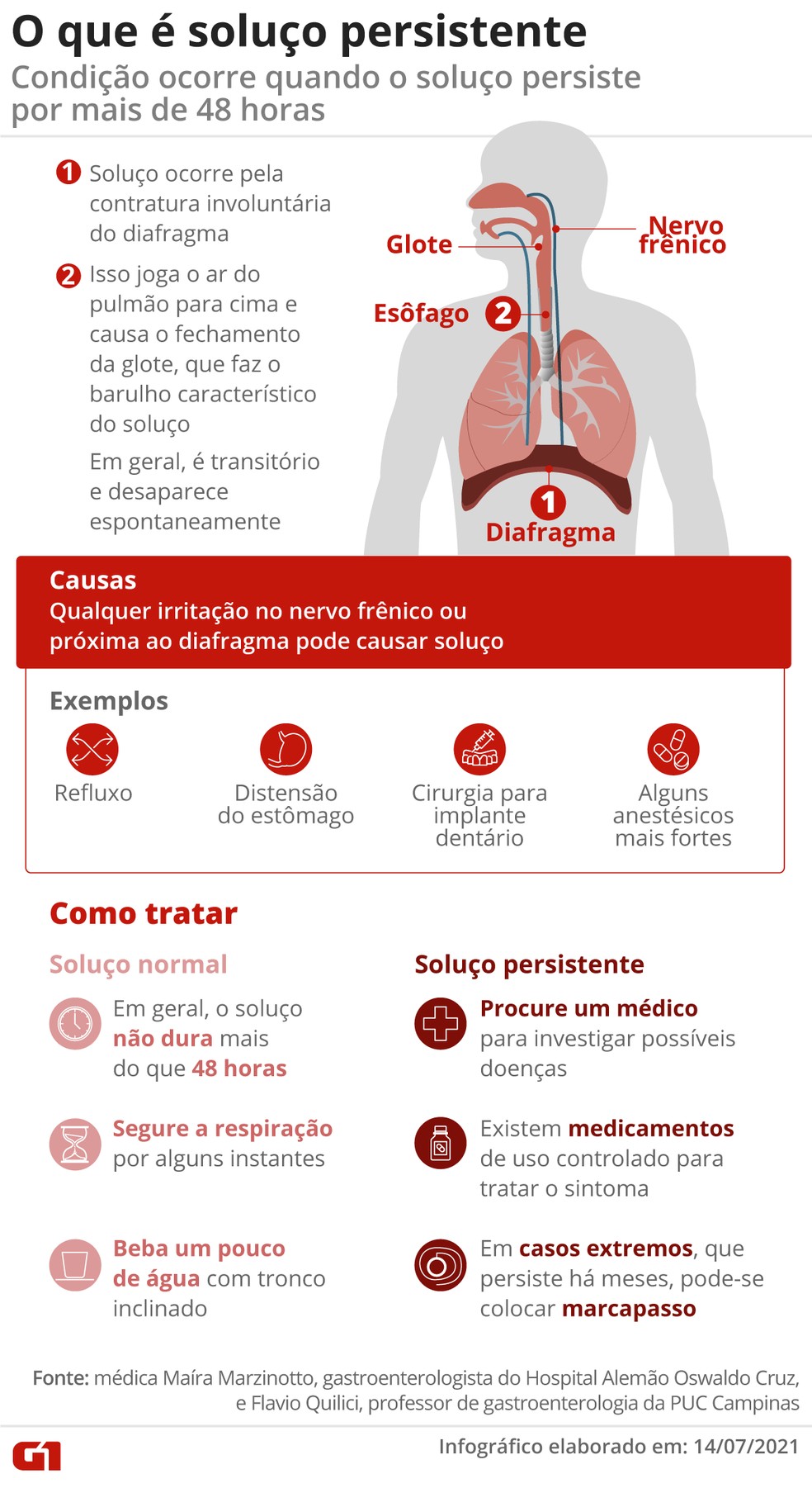 Remédios caseiros eficazes para parar o soluço imediatamente
