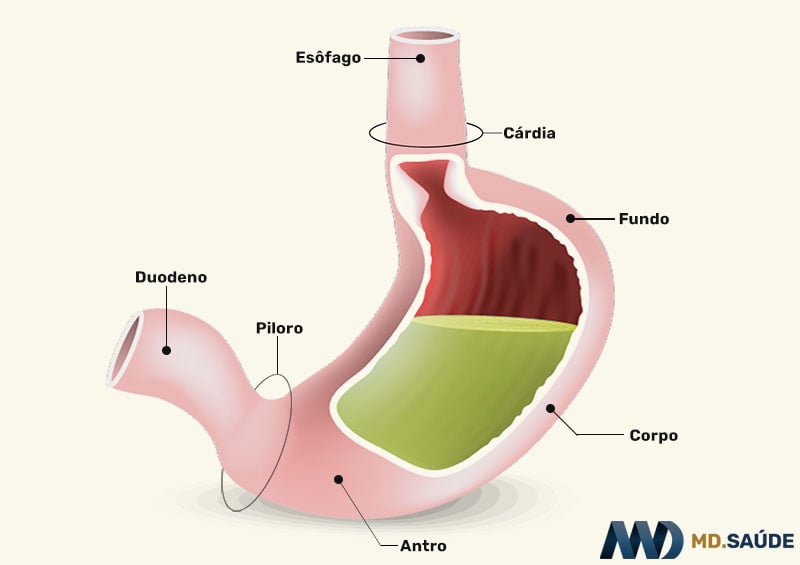 Gastrite Enantematosa: Entenda os Sintomas e Causas