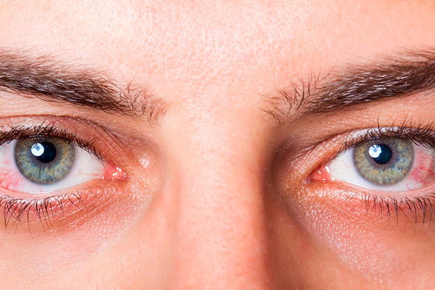 5 ideias de títulos:
1. Olho Seco: Guia Completo de Sintomas e Causas
2. Tratamentos Eficazes para Aliviar o Desconforto do Olho Seco
3. Como Fatores Ambientais e Hormonais Afetam a Saúde Ocular
4. Olho Seco e Lentes de Contato: Mitos e Verdades
5. Prevenção e Cuidados Essenciais para Olhos Saudáveis