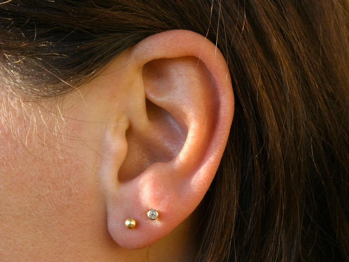 Orelha Inflamada Por Brinco