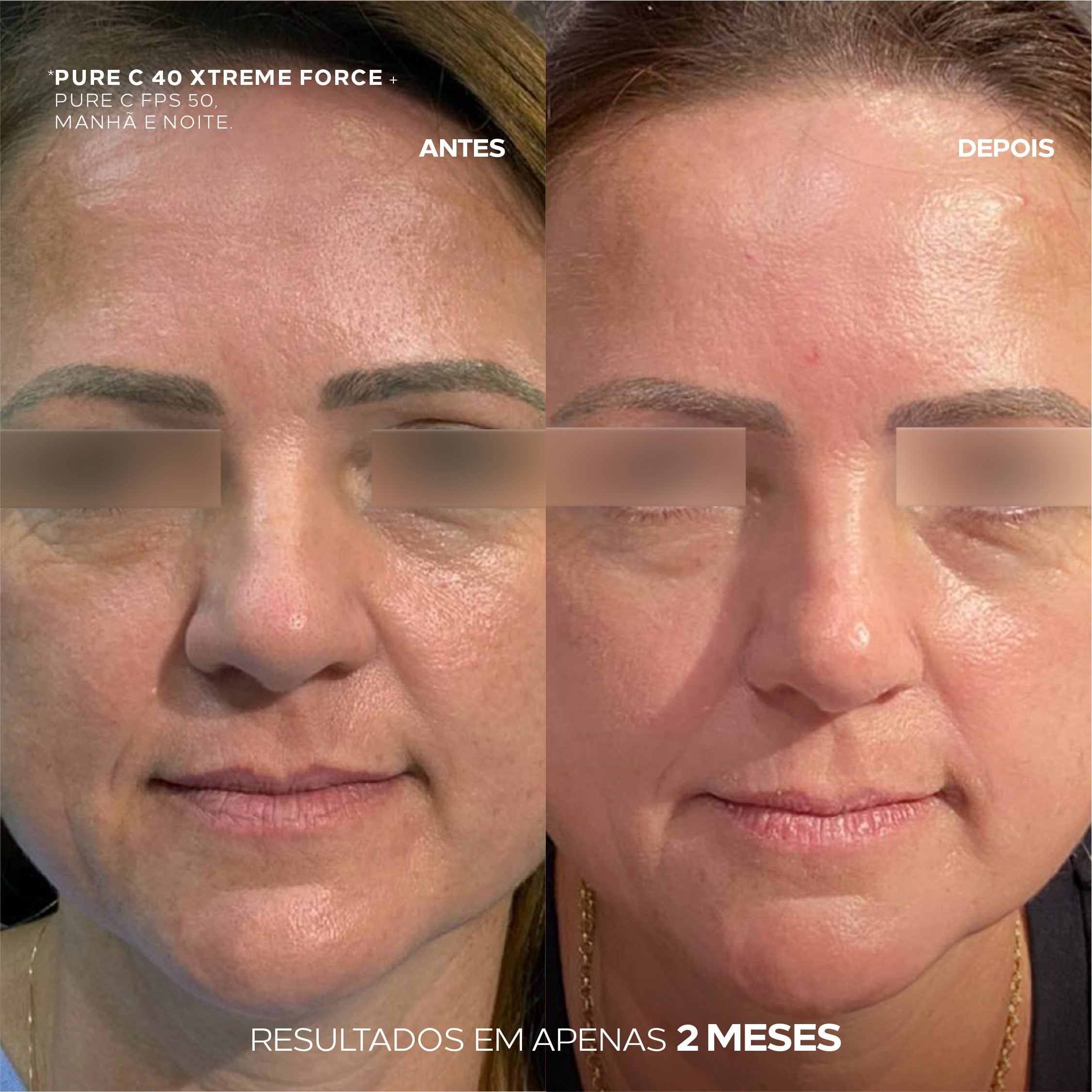 Vanish Oxi Action vs. Oxi-White: Qual o melhor para suas roupas?