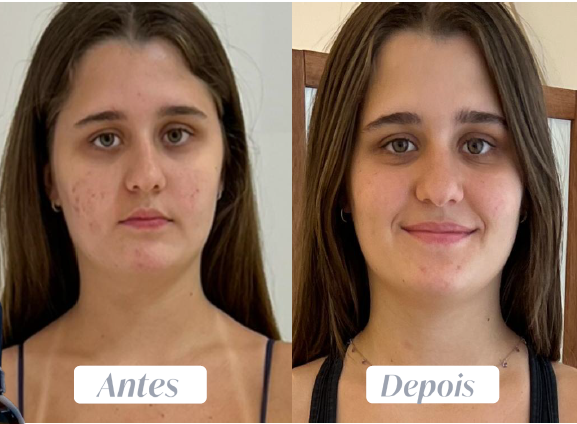 Vanish Oxi Action vs. Oxi-White: Qual o melhor para suas roupas?