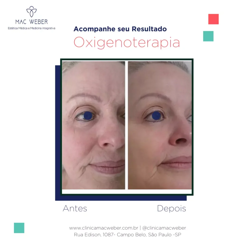 Oxandrolona: Mitos e Verdades sobre o uso no fitness