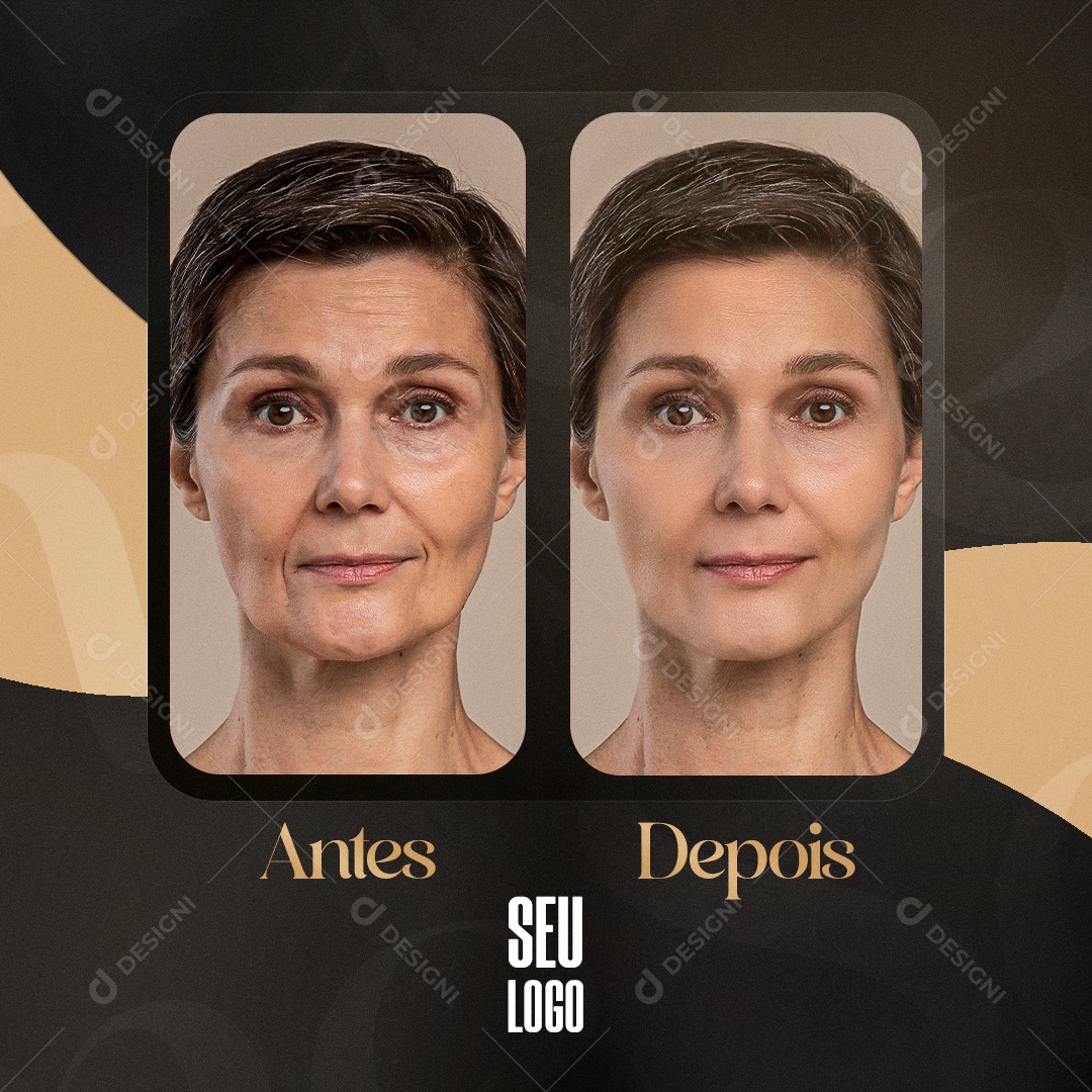 O Poder da Limpeza de Pele: Antes e Depois que Impressionam