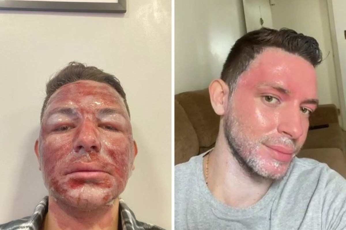 O Poder da Limpeza de Pele: Antes e Depois que Impressionam