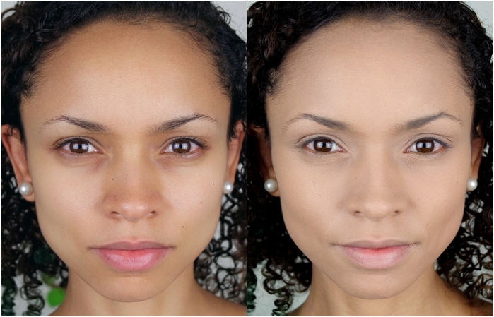 Rejuvenescimento Facial: Mitos e Verdades em Fotos de Antes e Depois