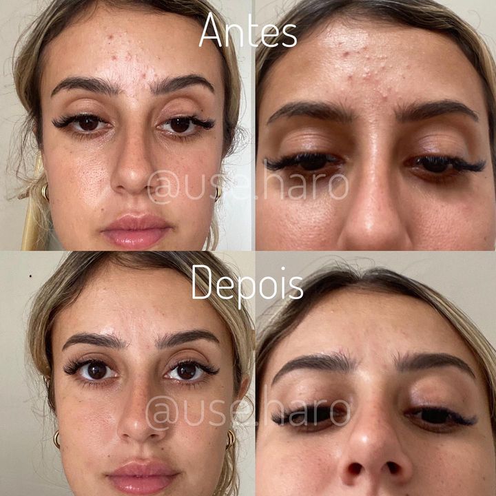 Rotina de Skincare Essencial para Potencializar Seus Resultados