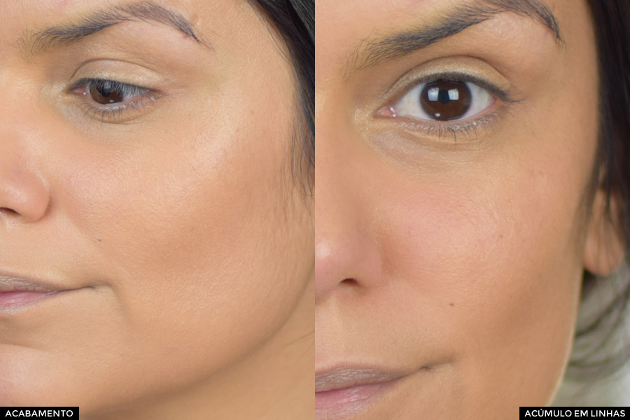 Ácido Salicílico em Protetores Solares: Benefícios para Peles Acneicas