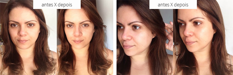 Protetor Solar Mineral vs. Químico: Qual o Melhor para Você?