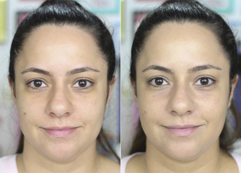 Rotina de Skincare para Peles Oleosas: Incluindo Protetor Solar com Cor