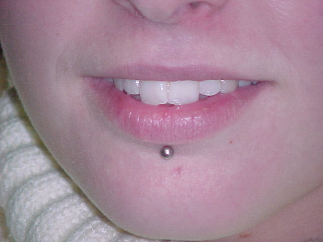 Piercing Labret e Saúde Bucal: Prevenindo Riscos e Complicações