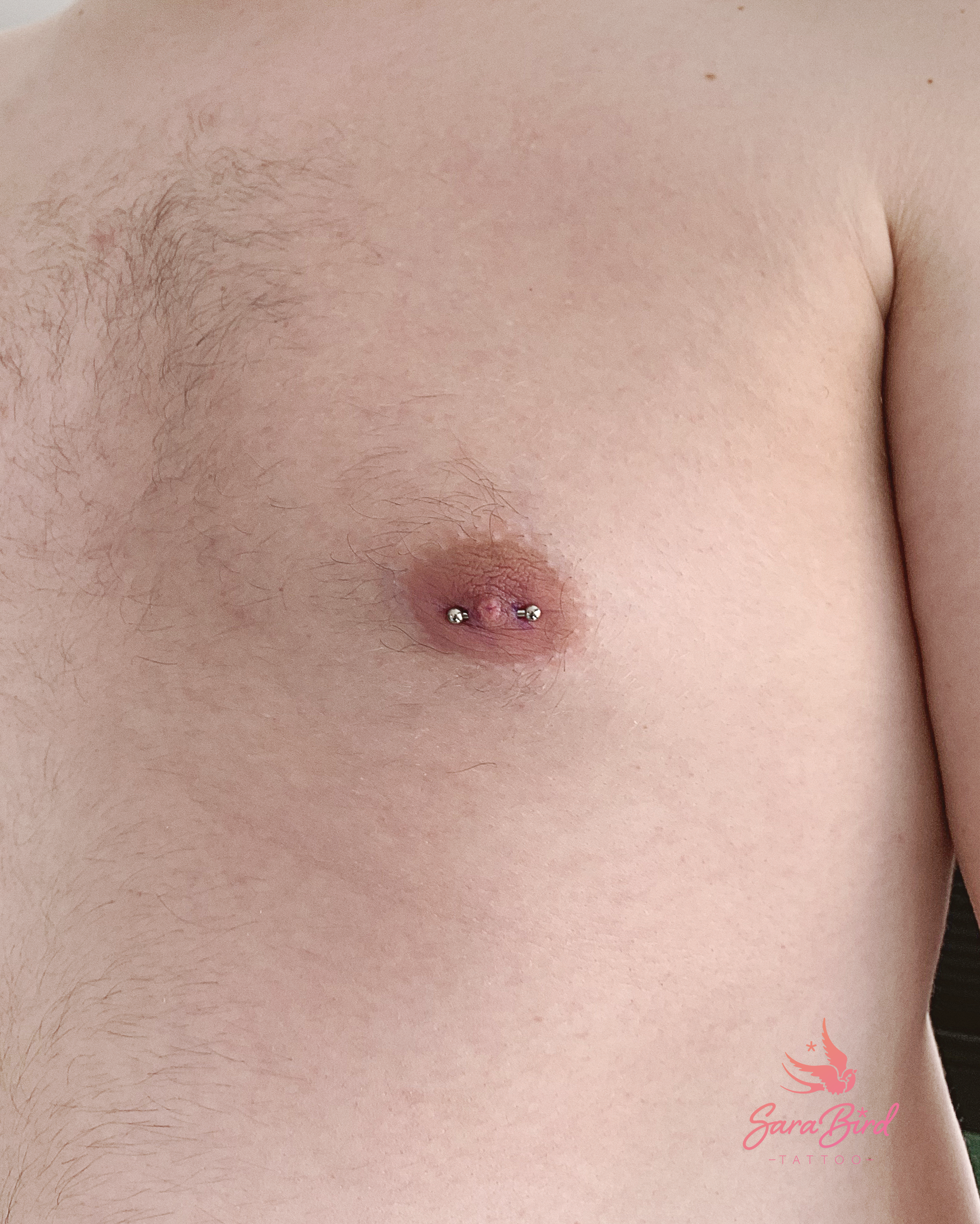 granuloma piercing mamilo