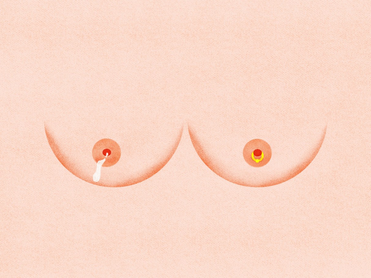 piercing mamilo gestante