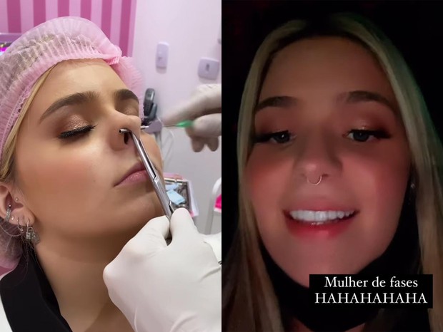 cicatrização piercing septo