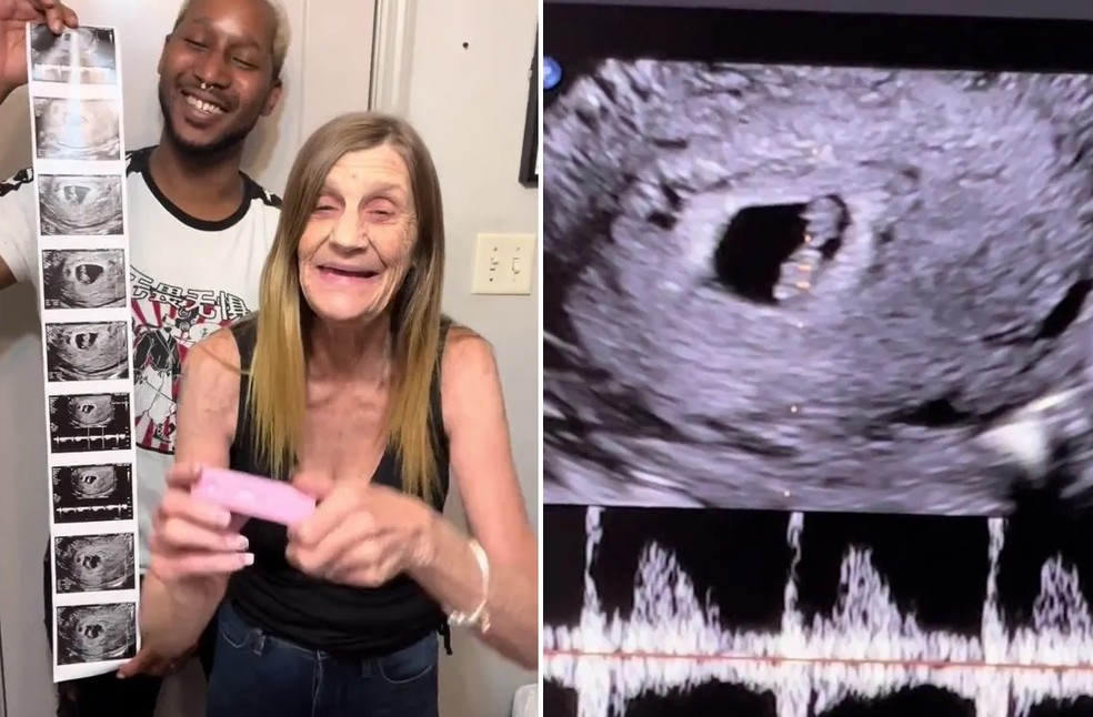 gravidez tardia riscos e cuidados