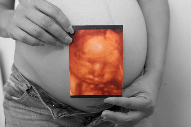 Primeira Gravidez Aos 37 Anos