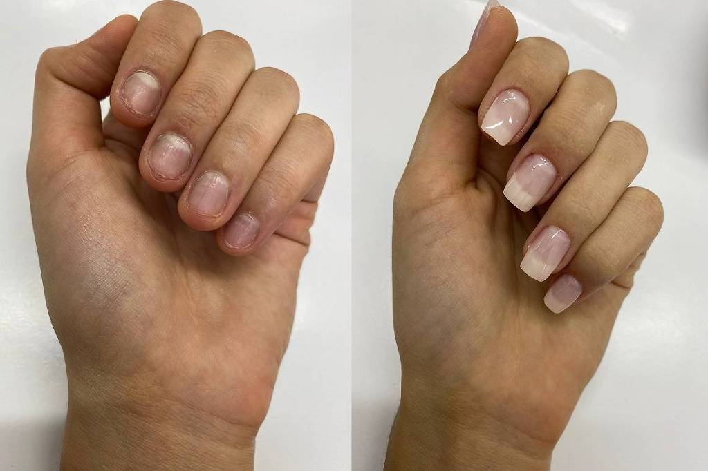 problemas unhas fibra vidro como resolver