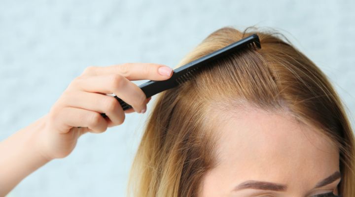 Queda de Cabelo Feminina vs. Masculina: Diferenças e Abordagens