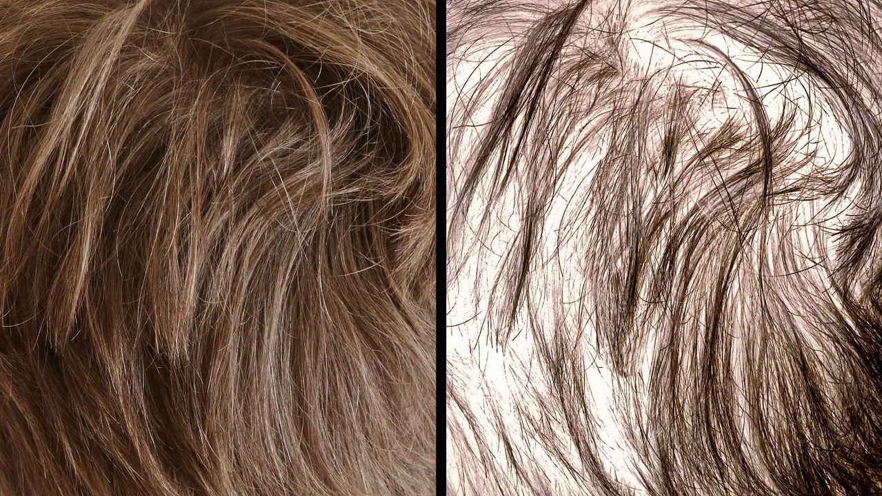 Os Melhores Alimentos para Prevenir a Queda de Cabelo: Guia Completo