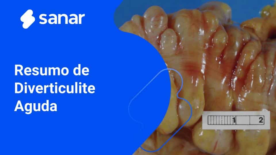 antibiótico para diverticulite preço