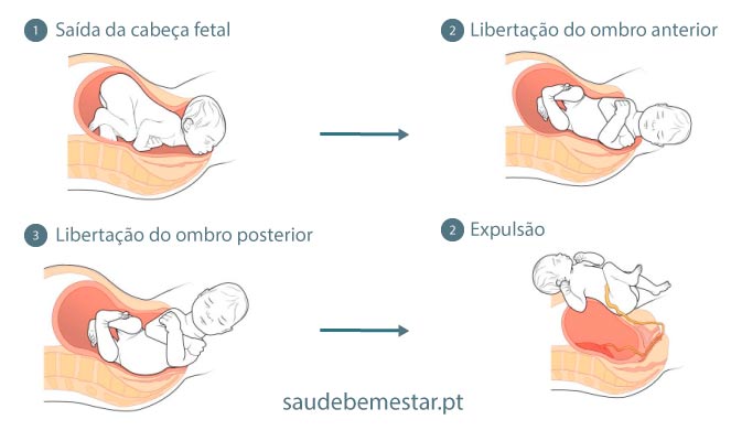 1. Entendendo as Fases do Lóquio: Um Guia Completo
2. Sangramento Pós-Parto: Sinais de Alerta e Quando Procurar Ajuda Médica
3. Cuidados Essenciais Durante o Puerpério: O Que Saber Sobre o Sangramento
4. Amamentação e Sangramento Pós-Parto: O Que Esperar?
5. Mitos e Verdades Sobre o Sangramento Pós-Parto