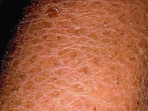 sastid shampoo 120ml onde comprar