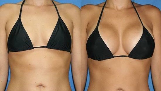 Silicone para banheiro 300ml