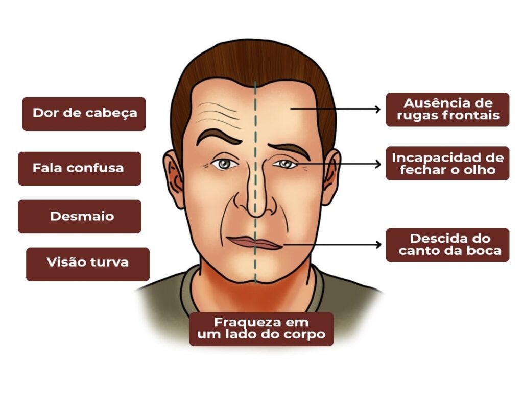 como identificar um derrame na hora