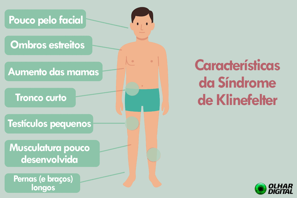 Infertilidade Masculina e Síndrome de Klinefelter: Opções de Reprodução Assistida