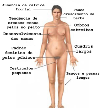 XXY: Entenda o Diagnóstico da Síndrome de Klinefelter