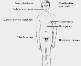 Terapia de Reposição Hormonal para Síndrome de Klinefelter: Benefícios e Riscos