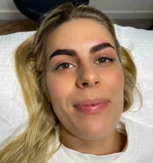 tratamentos para crescimento de sobrancelha