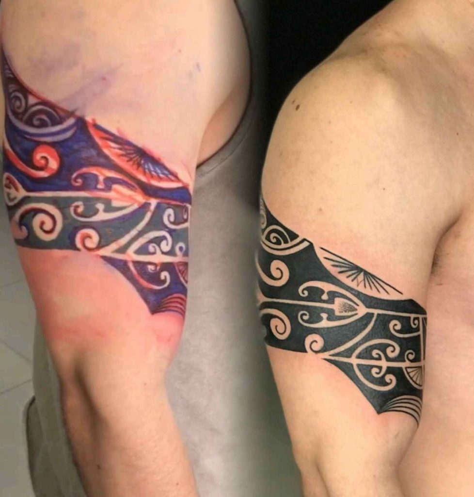 cover up vs remoção a laser qual o melhor