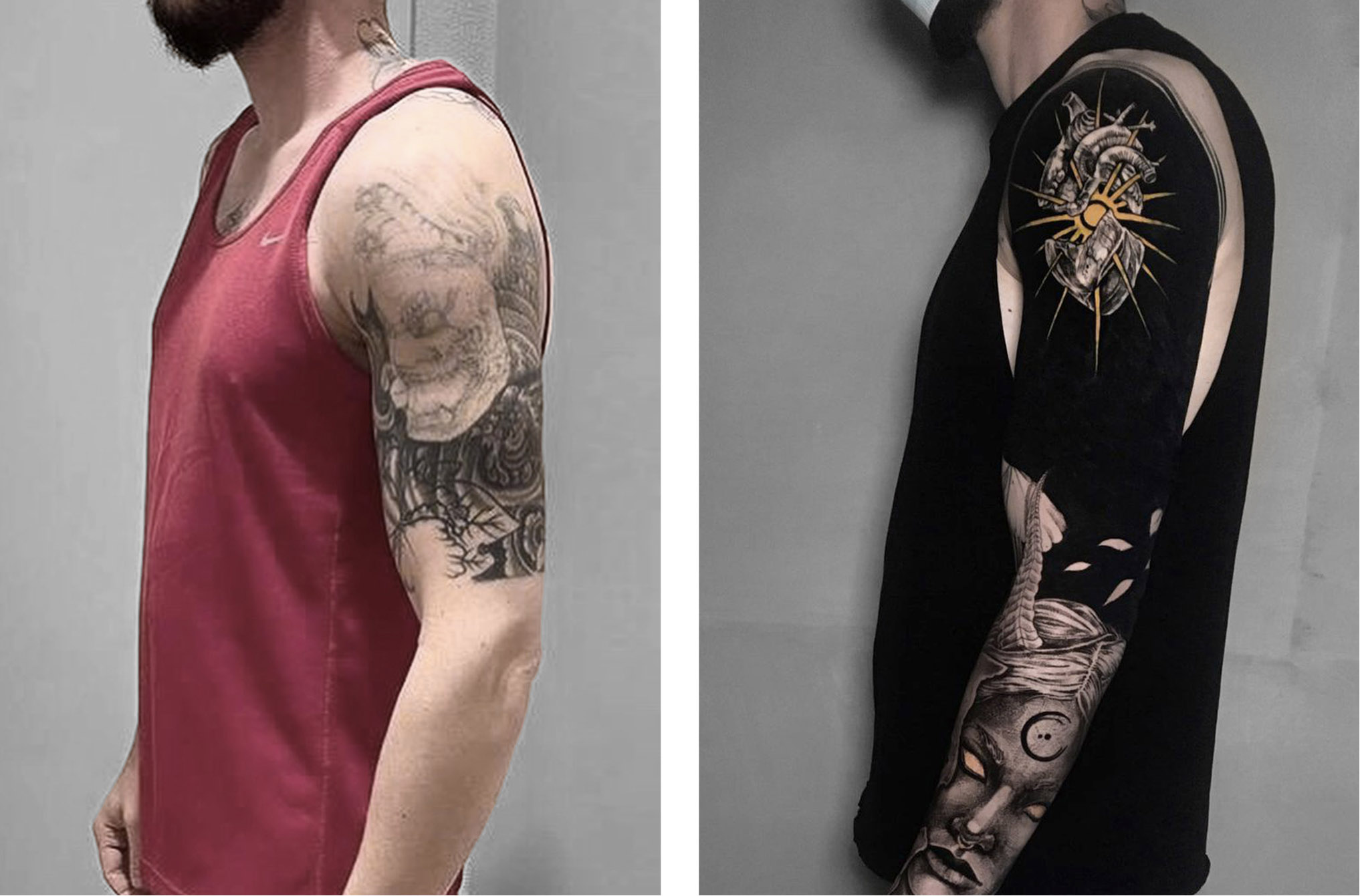 cover up vs remoção a laser qual o melhor