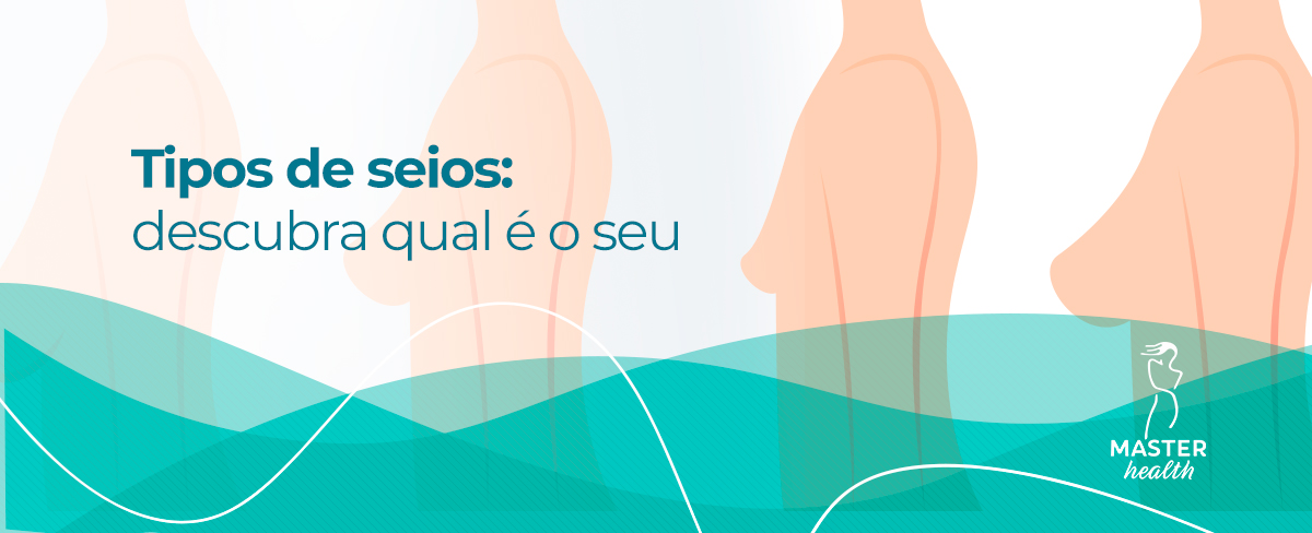 Mitos e verdades sobre os diferentes tipos de seios