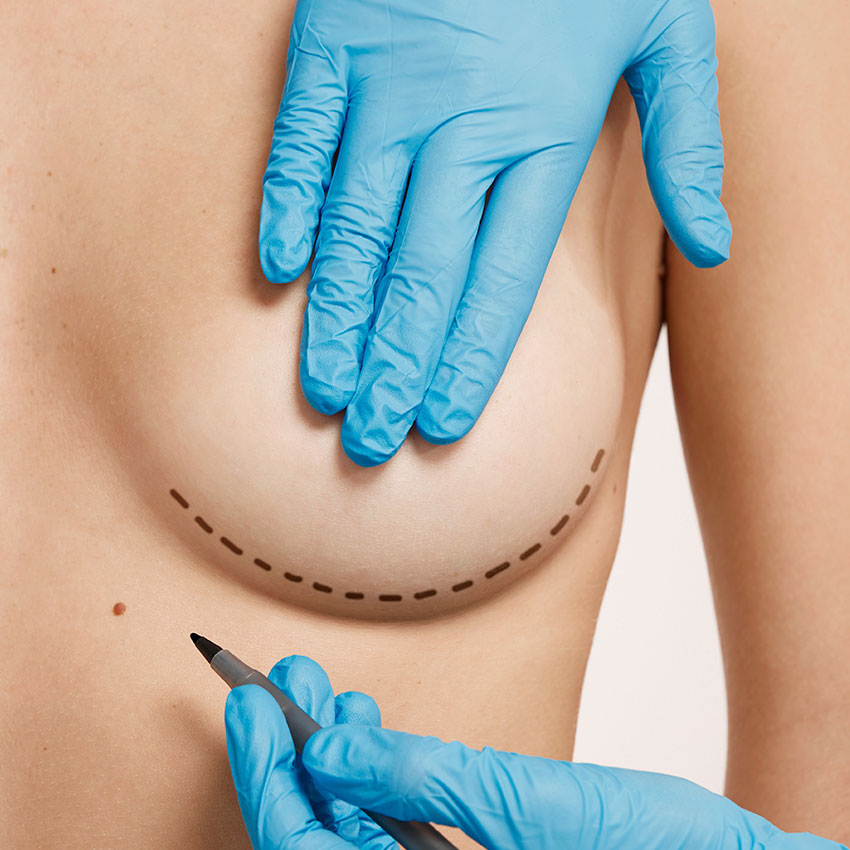 Entenda a sustentação: Por que o sutiã certo faz a diferença?