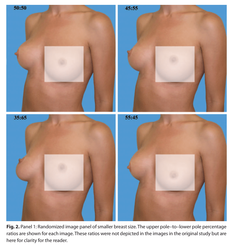 Quando a assimetria mamária é motivo de preocupação?